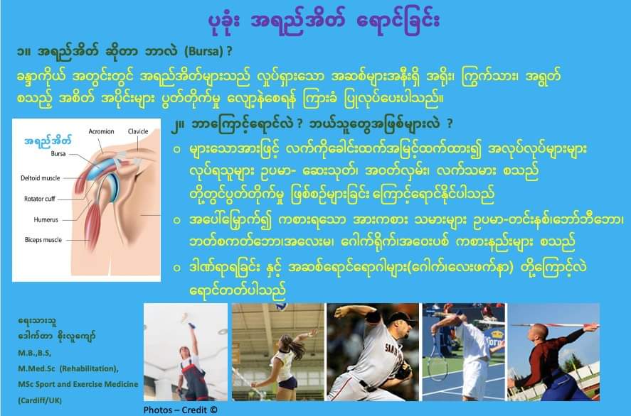 ပုခုံး အရည်အိတ် ရောင်ခြင်း » ဒေါက်တာစိုးလူကျော်