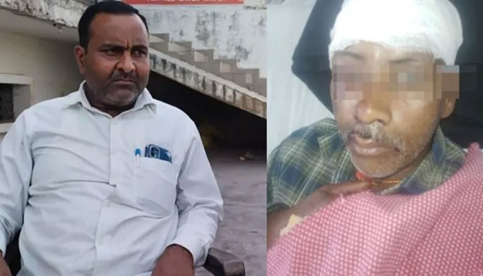 Bahraich: Head smashed, jaw torn- Sudhakar Tiwari was attacked by an Islamist mob