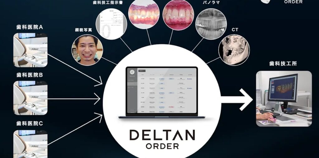 歯科DX推進のDeltan、5億円を調達——〝仮想API〟＆技工所起点の営業戦略で業界の壁に挑む - BRIDGE（ブリッジ）テクノロジー＆スタートアップ情報