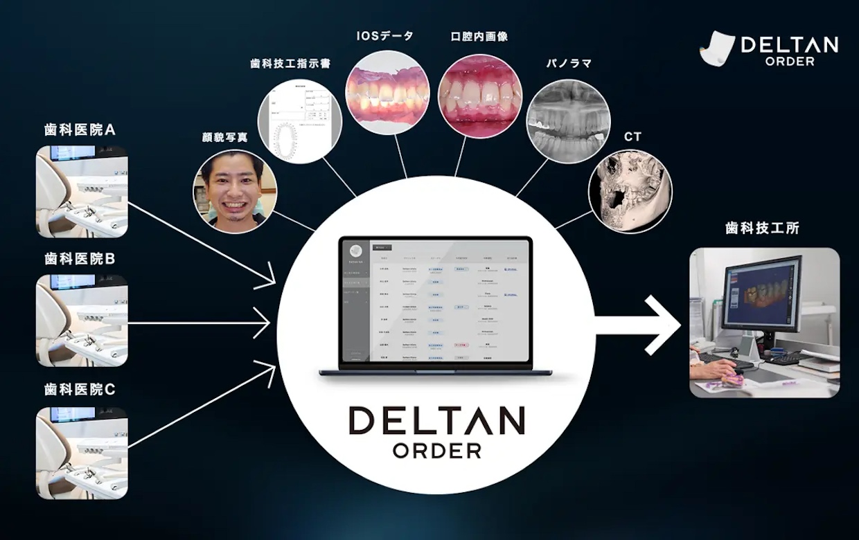 歯科DX推進のDeltan、5億円を調達——〝仮想API〟＆技工所起点の営業戦略で業界の壁に挑む – BRIDGE（ブリッジ）テクノロジー＆スタートアップ情報