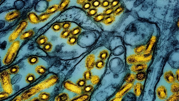 Cause of B.C. teen's H5N1 avian flu infection still unknown, health officials say | CBC News