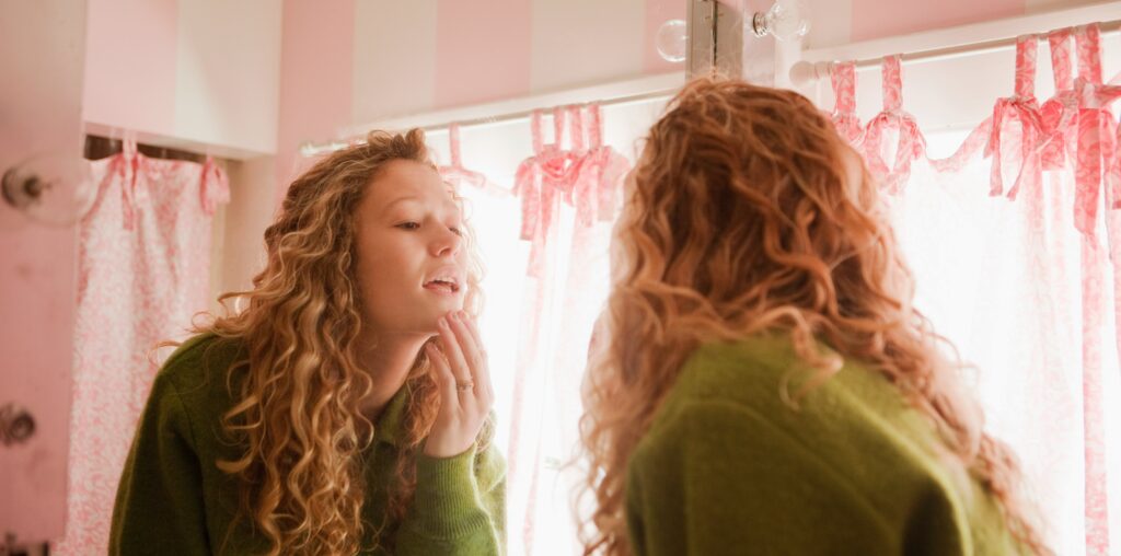 Facial Dandruff Is Real — and Different From Dry Skin