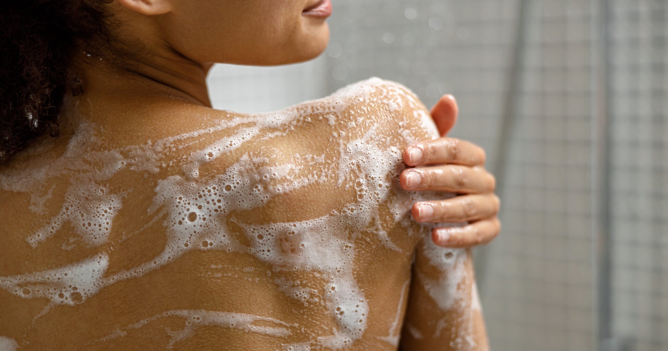 How to Avoid Skin Rash After Showering, According to Dermatologists