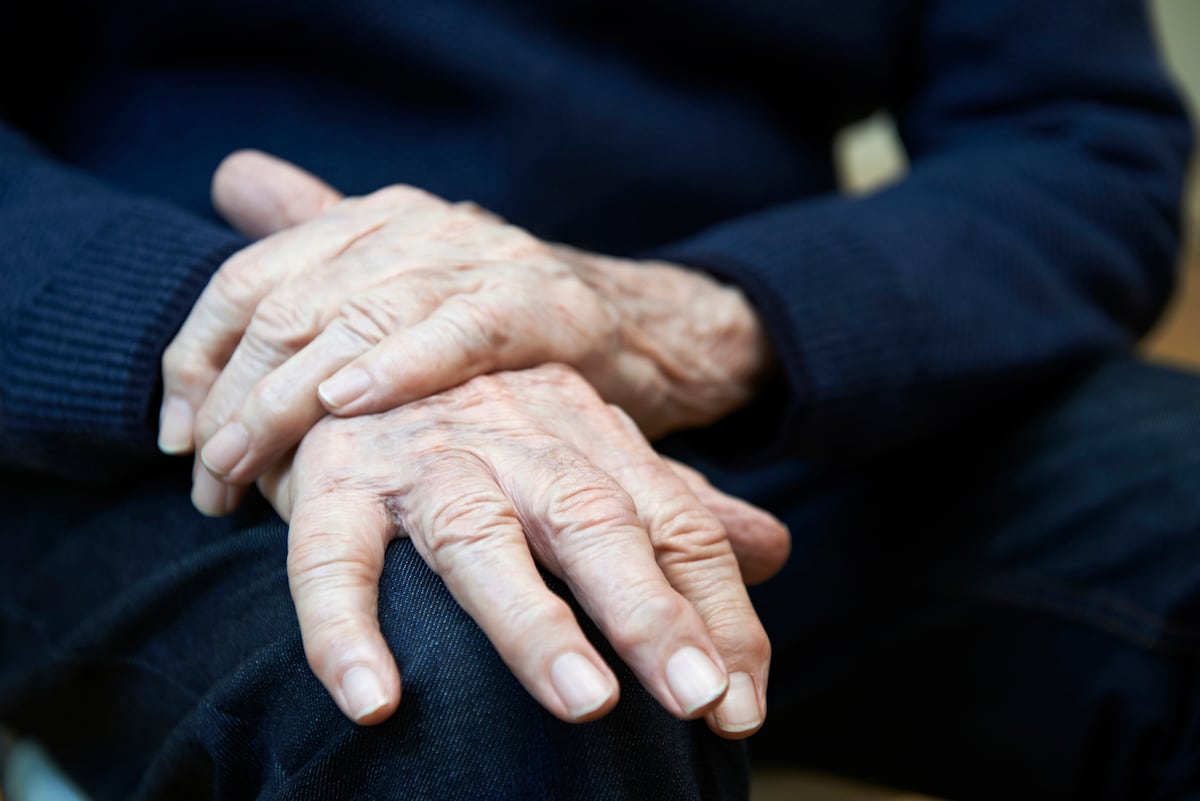 La proteína del párkinson está en los cerebros de los pacientes con trastorno del sueño REM