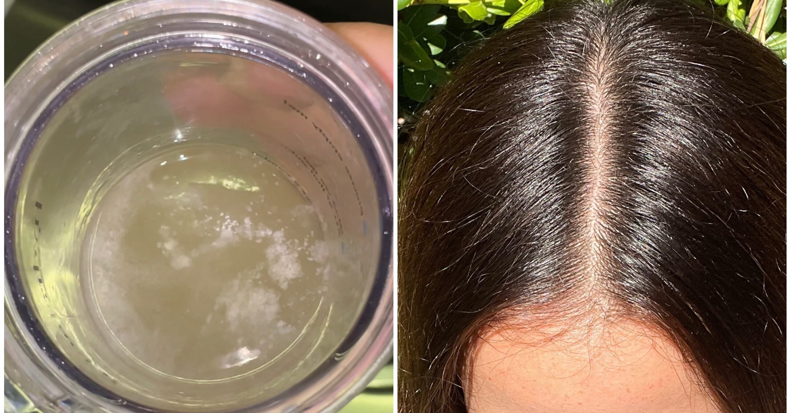 My Scalp Was Itchy and Dry Until I Tried a Scalp “Detox”